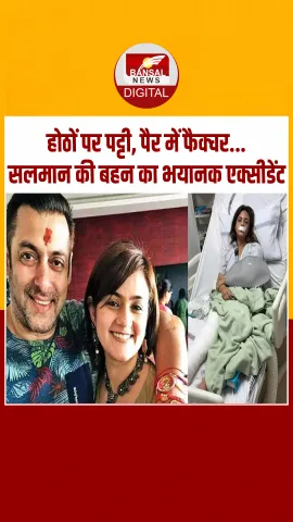 Salman Khan की राखी बहन का हुआ भयानक एक्सीडेंट, सोशल मीडिया पर खुद शेयर की फोटोज