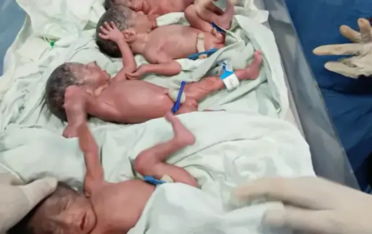 Bhopal Quadruplet Birth