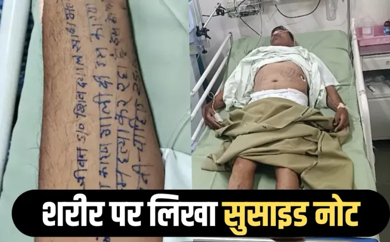 नर्मदापुरम में खुदकुशी की कोशिश: हाथ-पैर पर लिखा सुसाइड नोट फिर खाया सल्फास, उपसरपंच पति पर लगाए प्रताड़ना के आरोप
