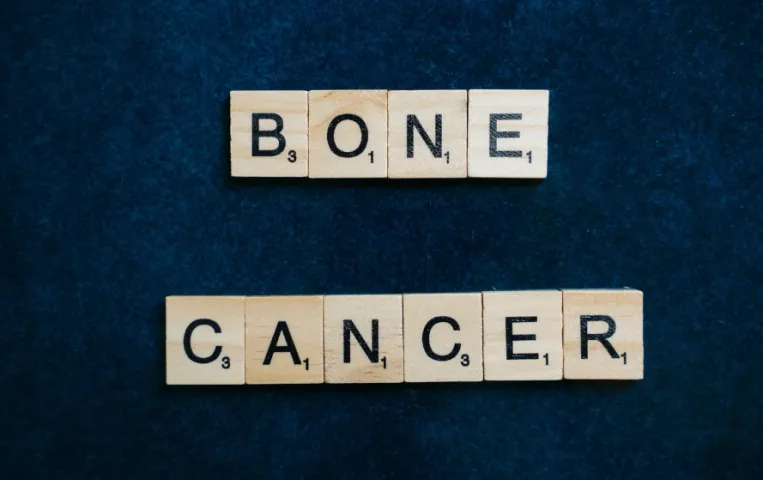 BoneCancer: बच्चों में तेजी से बढ़ रहा है बोन कैंसर, ये लक्षण हैं बोन कैंसर के संकेत!