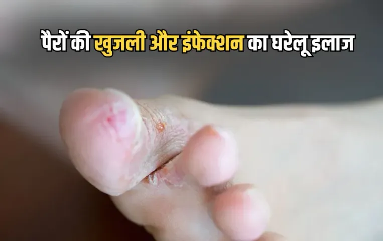 Monsoon Foot Care Tips