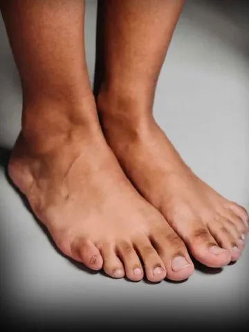 Blackness Removing Tips