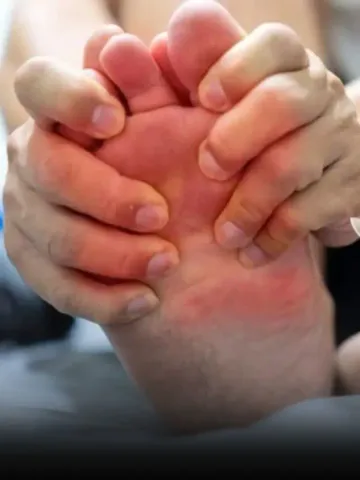 Uric Acid Patients Health Tips