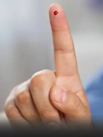 World Diabetes Day Sugar Test without blood New Device