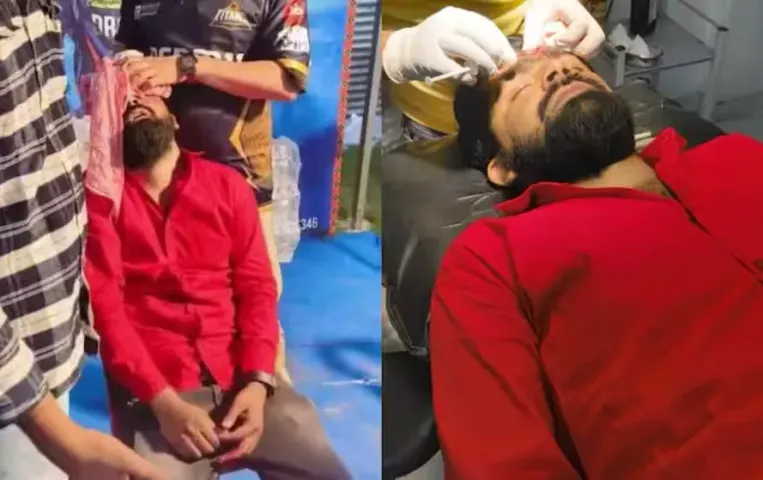 Nicholas Pooran Short: सिर में आए 8 टांके, लखनऊ के इकाना स्टेडियम में निकोलस पूरन की शॉट से घायल हुआ दर्शक