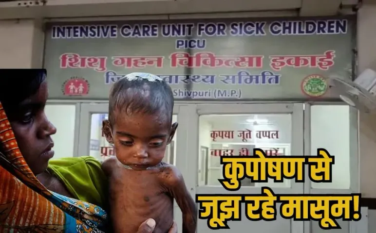 MP Kuposhan: मध्यप्रदेश के इस जिले में कुपोषण ने फिर पैर पसारे, 14 बच्चे अस्पताल में भर्ती, उल्टी-दस्त से बिगड़ी हालत