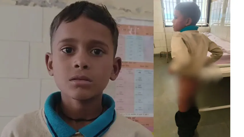 School teacher beating 2nd class student