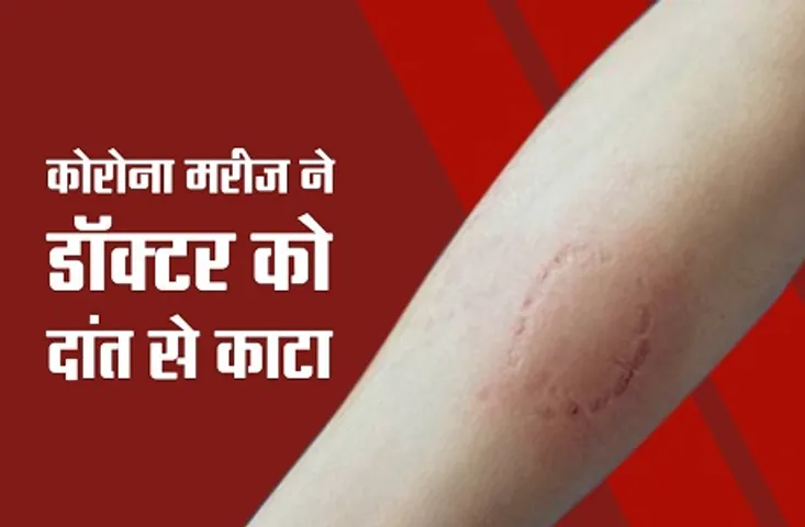 मरीज और स्वास्थ्य कर्मी के बीच हुआ विवाद, गुस्से में आकर कोरोना पेशेंट ने डॉक्टर के हाथ पर दांतों से काटा