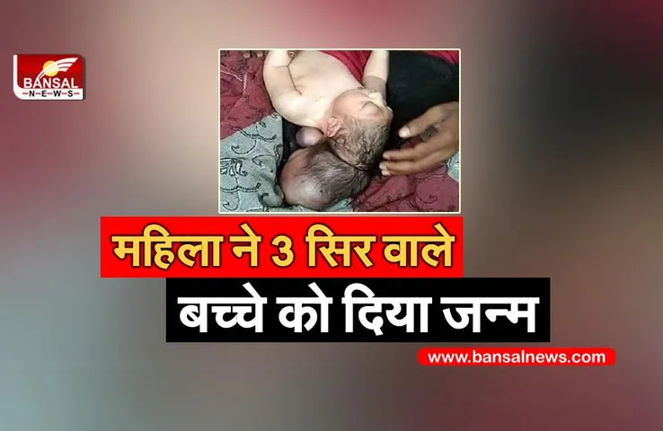 Mainpuri: तीन सिर वाले बच्चे को देख लोगों के उड़े होश, कोई मैन्युफैक्चरिंग फॉल्ट बता रहा है तो कोई बता रहा भगवान का अवतार