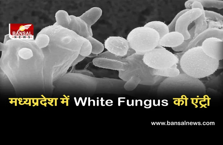 मध्यप्रदेश में अब व्हाइट फंगस की एंट्री, जबलपुर में मिला पहला मामला