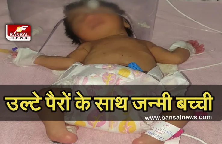 Breaking News: उल्टे पैरों के साथ जन्मी बच्ची, नजारा देख अस्पताल छोड़ भागे माता-पिता