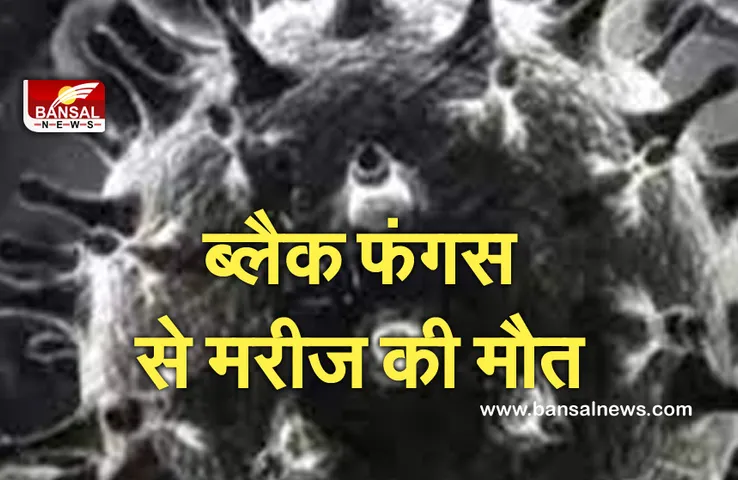 Corona Third Wave In MP: अगस्त में ब्लैक फंगस के मरीज की पहली मौत, मंगलवार को इस अस्पताल में भर्ती हुए 4 मरीज