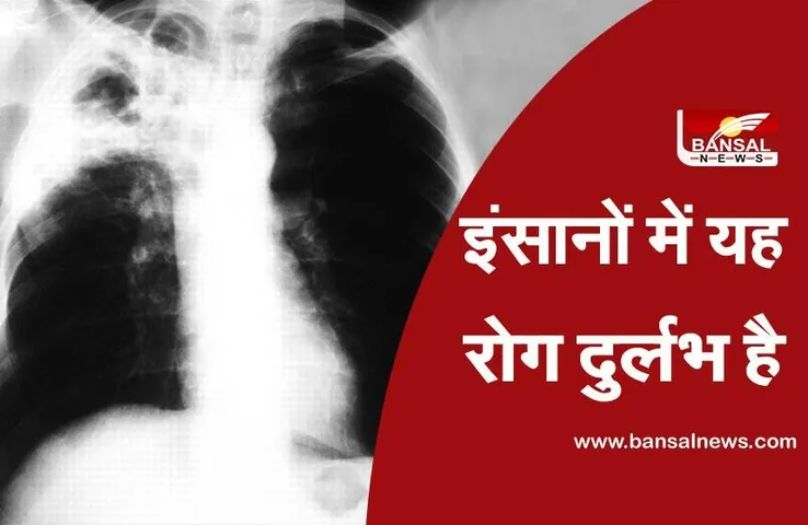 Melioidosis: मध्य प्रदेश में कोरोना के बाद एक और बैक्टीरिया का अटैक, शिवपुरी में 16 वर्षीय किशोर की मौत