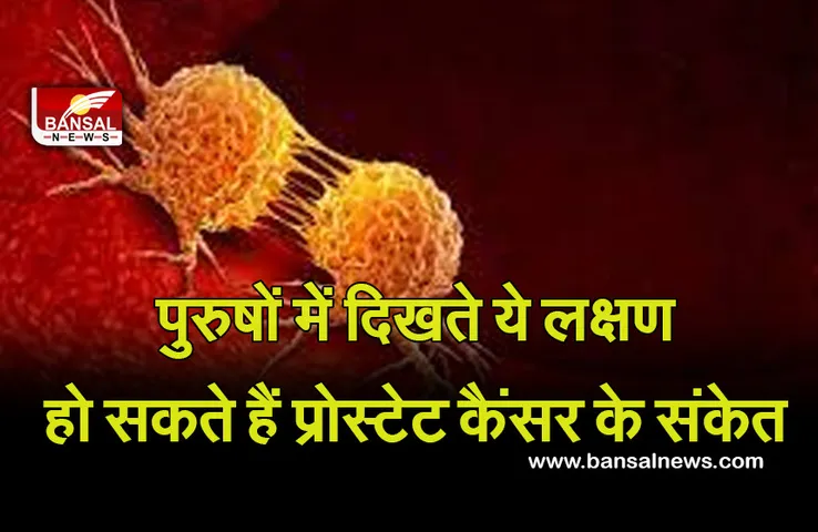 Prostate Cancer : अगर आपको भी दिखें ये लक्षण, हो जाएं सावधान! हो सकता है प्रोस्टेट कैंसर