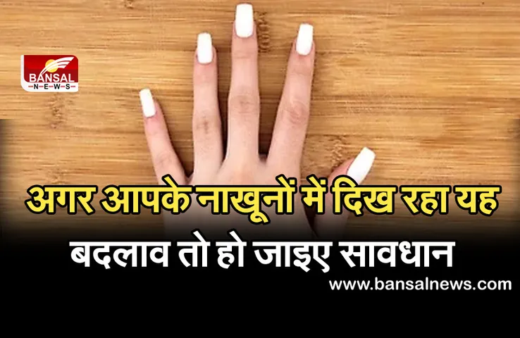 Covid Alert: नाखून कुछ बदले-बदले से लगें तो चौकन्ने हो जाइए: कहीं कोविड के कारण तो नहीं