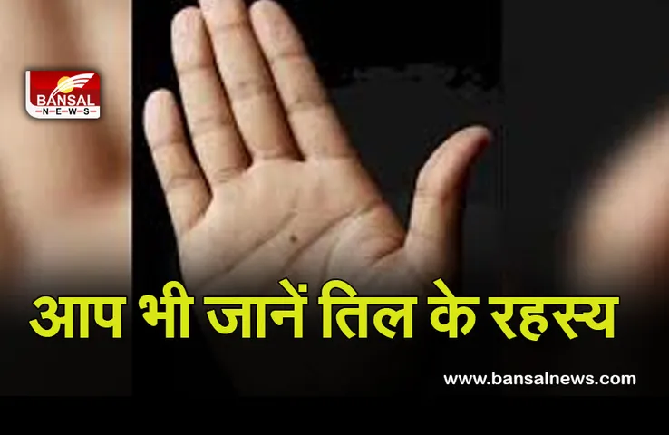 Moles on body : शरीर का तिल खोलेगा आपके राज, जानिए क्या है इसका महत्व