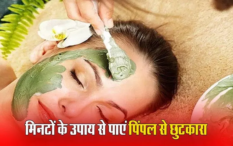 Acne Home Remedies: एक्ने की समस्या छीन सकती है आपके चेहरे का निखार, आजमाएं ये 5 आयुर्वेदिक उपाय