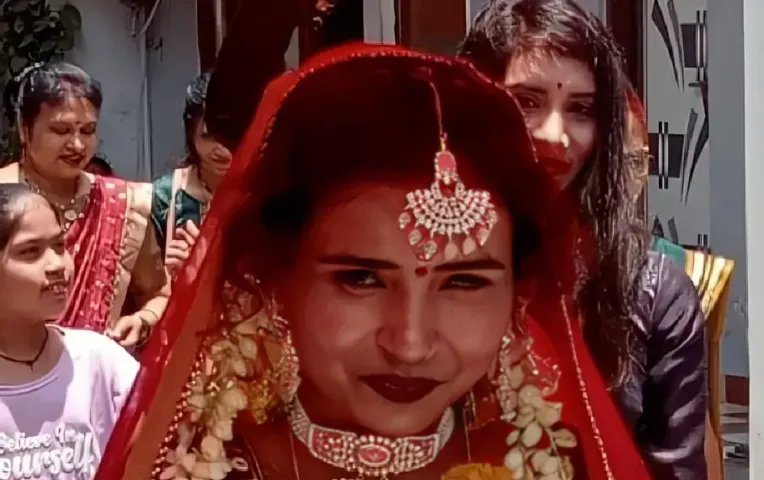 इंदौर में सात फेरे लेगी इंटरनेशनल डांसर: 5 साल पहले हुई थी एसिड अटैक की शिकार, जानें संघर्ष की कहानी