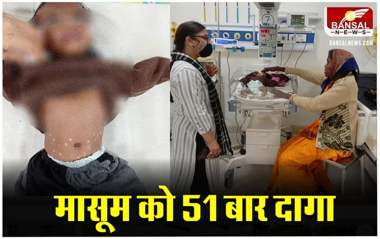 शहडोल| MP News: एक और बच्ची हुई अंधविश्वास की शिकार, अस्पताल में इलाज के दौरान हुई मौत