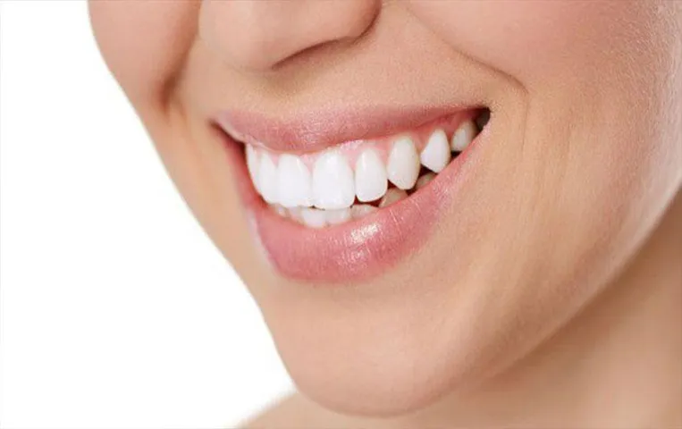 Teeth Whitening Tips: अपने दांतों को रखें हमेशा ब्राइट, आजमाएं ये घरेलू नुस्खे