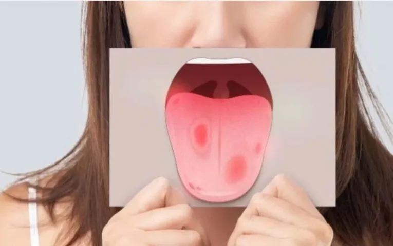 Tongue Cleaning Tips: गंदी जीभ दे सकती हैं गंभीर बीमारियां. ऐसे करें अपने जीभ की सफाई