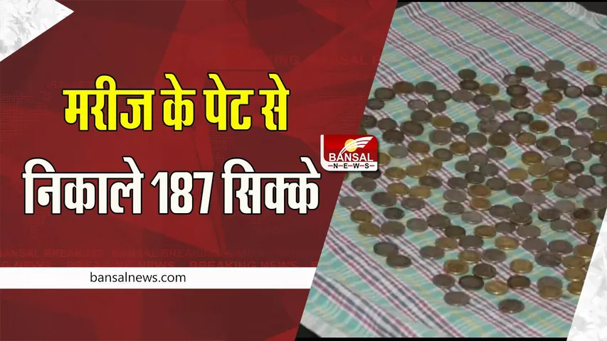 Karnataka Patient Stomach Coin: चौंकाने वाला मामला ! 58 साल के मरीज के पेट से निकले 187 सिक्के, जाने खबर