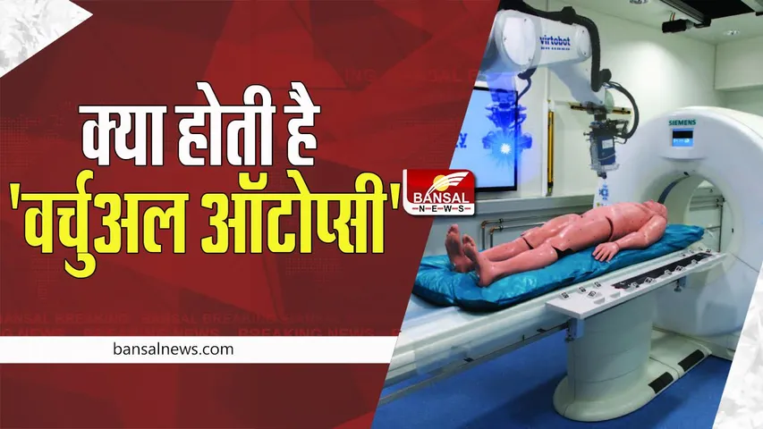 Virtual Autopsy : क्या आप जानते है शव को चीड़-फाड़ के बिना भी करते है ऐसे जांच ! जानिए इस तकनीक के बारे में
