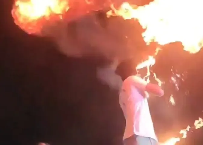 Fire Stunt: स्टंट का अजीब पागलपन, मुंह से आग निकालना पड़ा गया भारी, देखें वीडियो