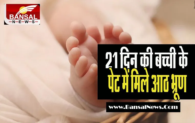 Jharkhand NewbornBig Breaking: चौंकाने वाली बड़ी खबर ! 21 दिन की बच्ची के पेट में मिले आठ भ्रूण