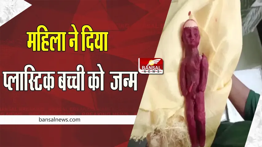 Plastic Child Delivery: चौंकिए ! जब डिलीवरी होने पर महिला को हुई प्लास्टिक सी बच्ची , फिर क्या हुआ पढ़ें इस खबर में