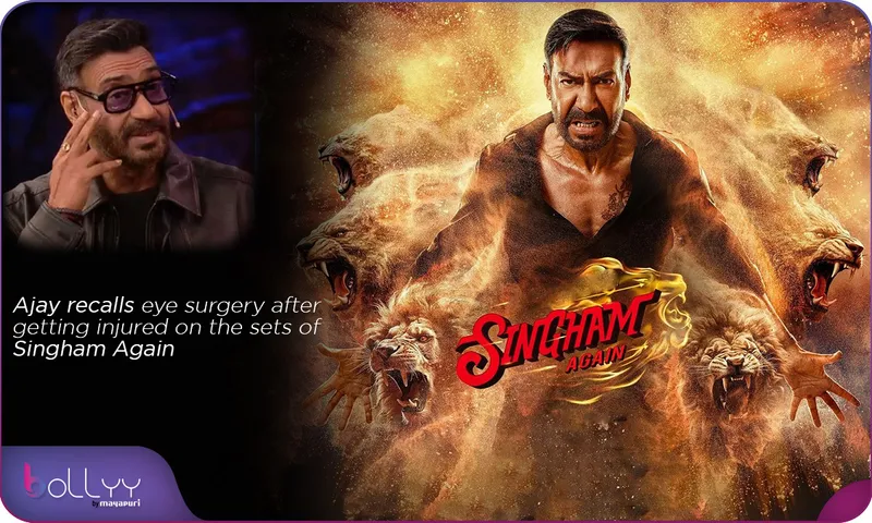 Ajay recalls eye surgery
