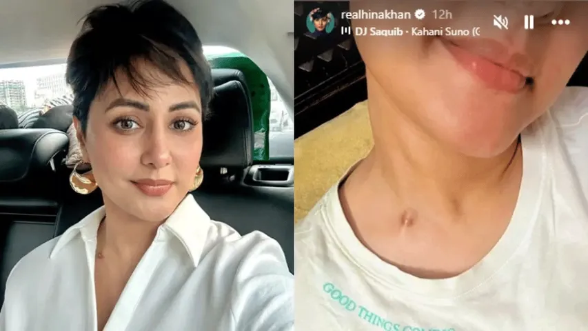 Hina Khan proudly flaunts her chemotherapy scars, fans praise her!