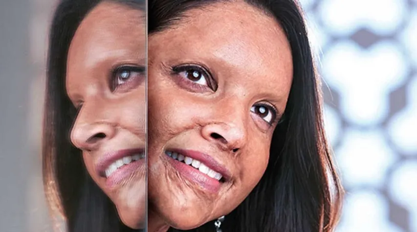 First Look: Deepika Padukone In Meghna Gulzar’s Chhapaak