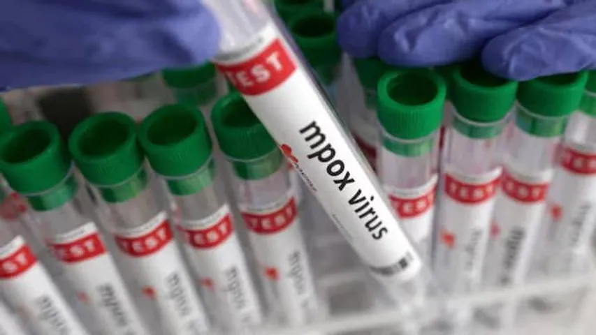 First Confirmed case of Mpox reported in New Delhi