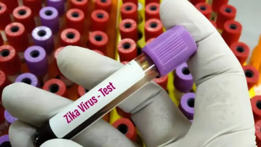 2 Pregnant women test +ve for Zika Virus in Pune, tally rises To 6