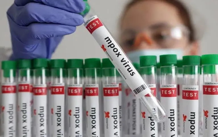 Indonesia prepares mpox screening ahead of Indonesia-Africa forum