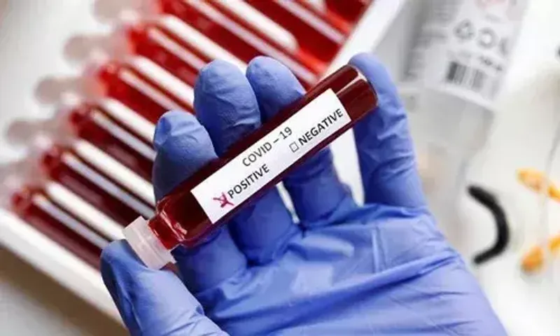 Covid 19 cases reached 71910 in Vadodara after 3 new cases on Monday