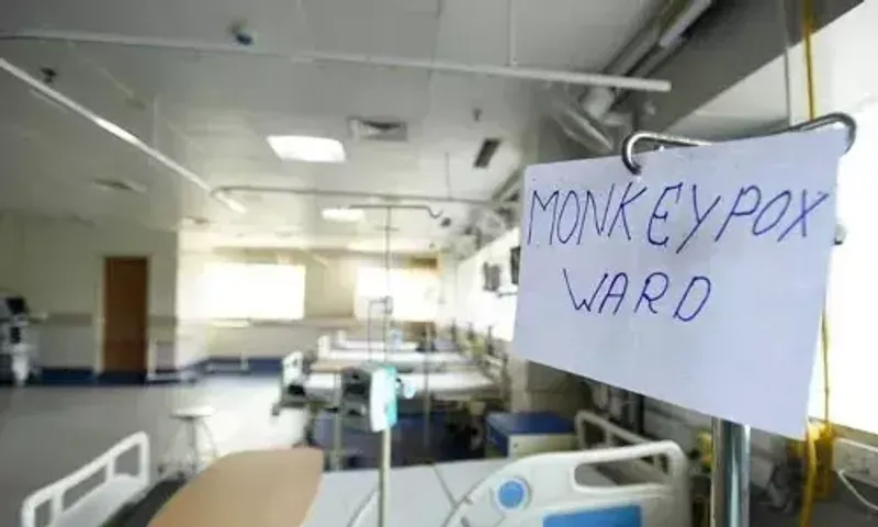 CDC Study: Monkeypox virus can stay on common household items