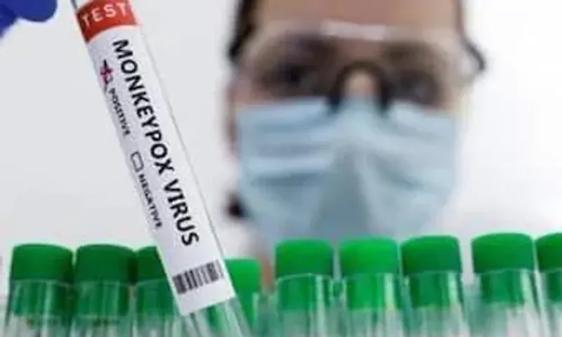 Delhi reports India's fourth monkeypox case