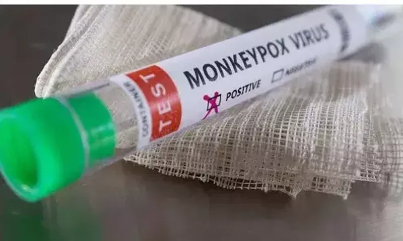 Monkeypox: Indian company develops RT-PCR kit to test for virus