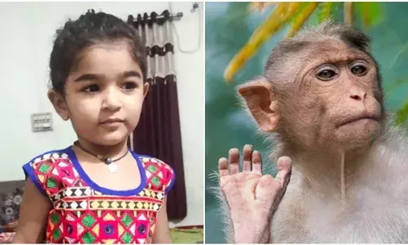Three and half year old girl recieved 60 stitches after bitten by monkey in Ajod village near Vadodara