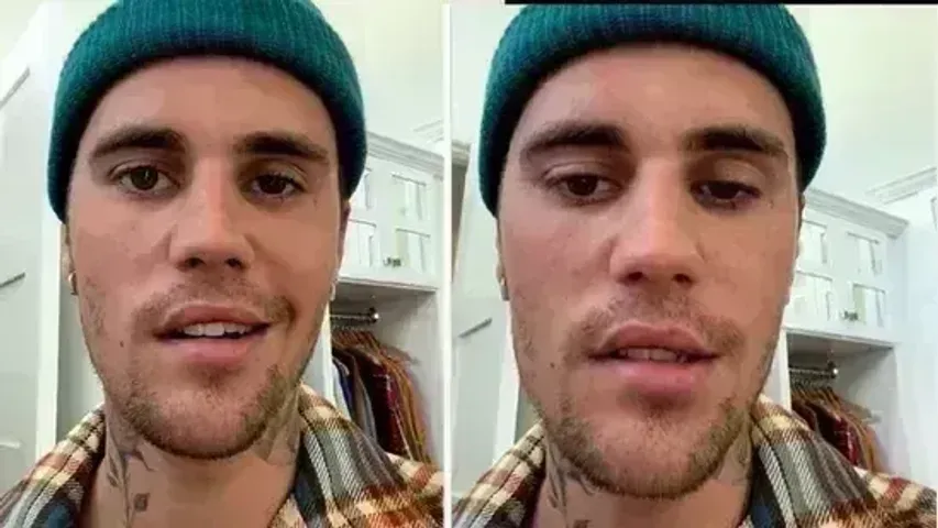 Justin Bieber says right side of his face is paralysed after virus attack, calls it 'pretty serious' condition