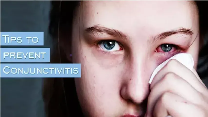 7 Easy Ways To Prevent 'Conjunctivitis'