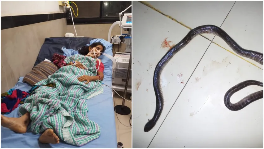 Woman bitten by poisonous snake in Savli