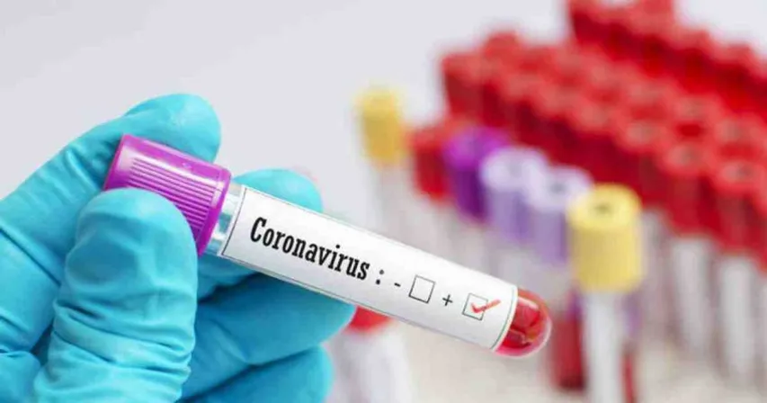Covid 19 cases reached 18027 in Vadodara after 112 new cases on Monday