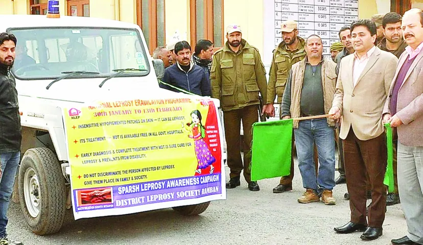 Sparsh Leprosy Awareness Campaign to be held during 30th January to 12th February