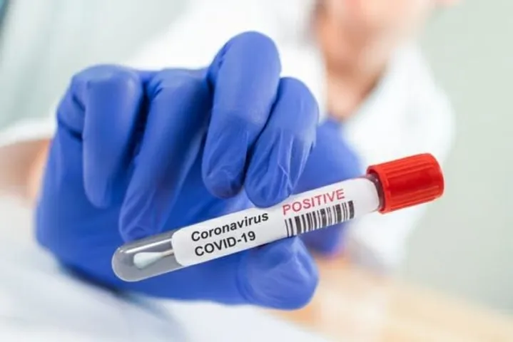 Covid 19 cases reached 23710 in Vadodara after 46 new cases on Friday