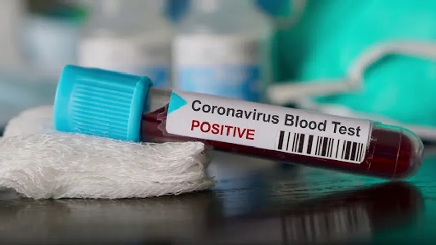 Covid 19 cases reached 25252 in Vadodara after 56 new cases on Thursday
