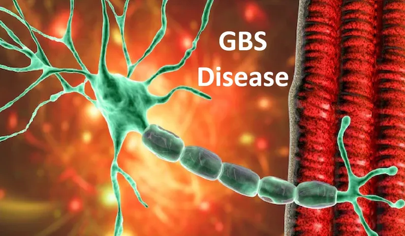 GBS-Disease