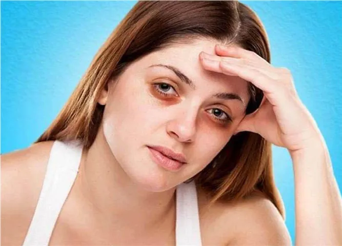 ડાર્ક સર્કલ 